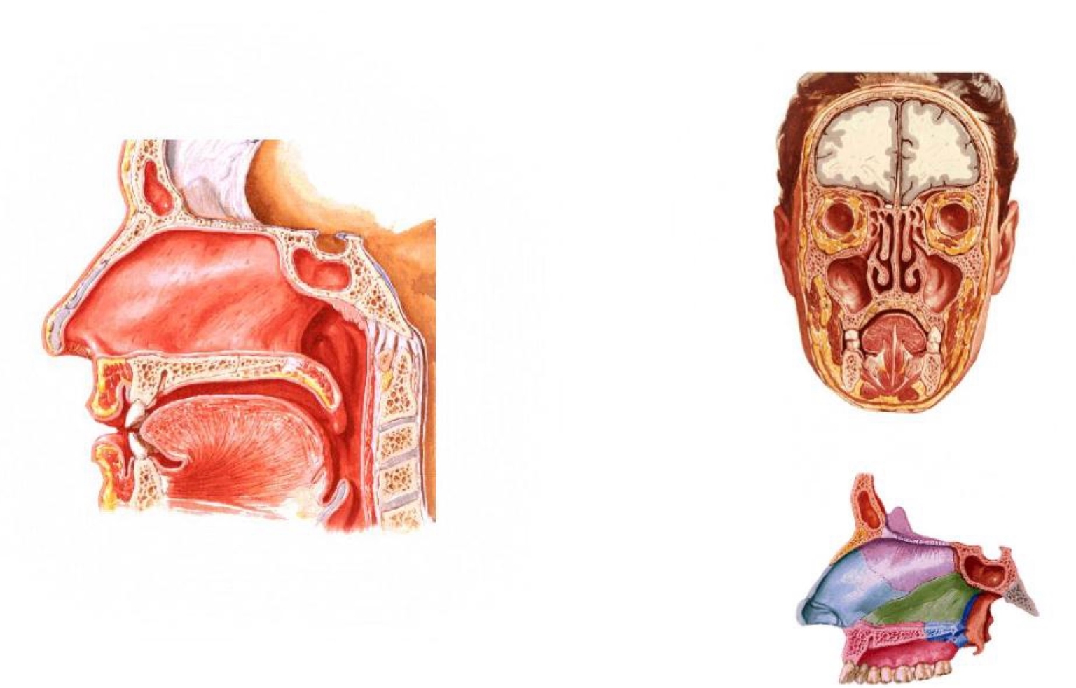 Thành trong - vách ngăn mũi gồm sụn, mảnh thẳng đứng xương sàng, xương lá mía