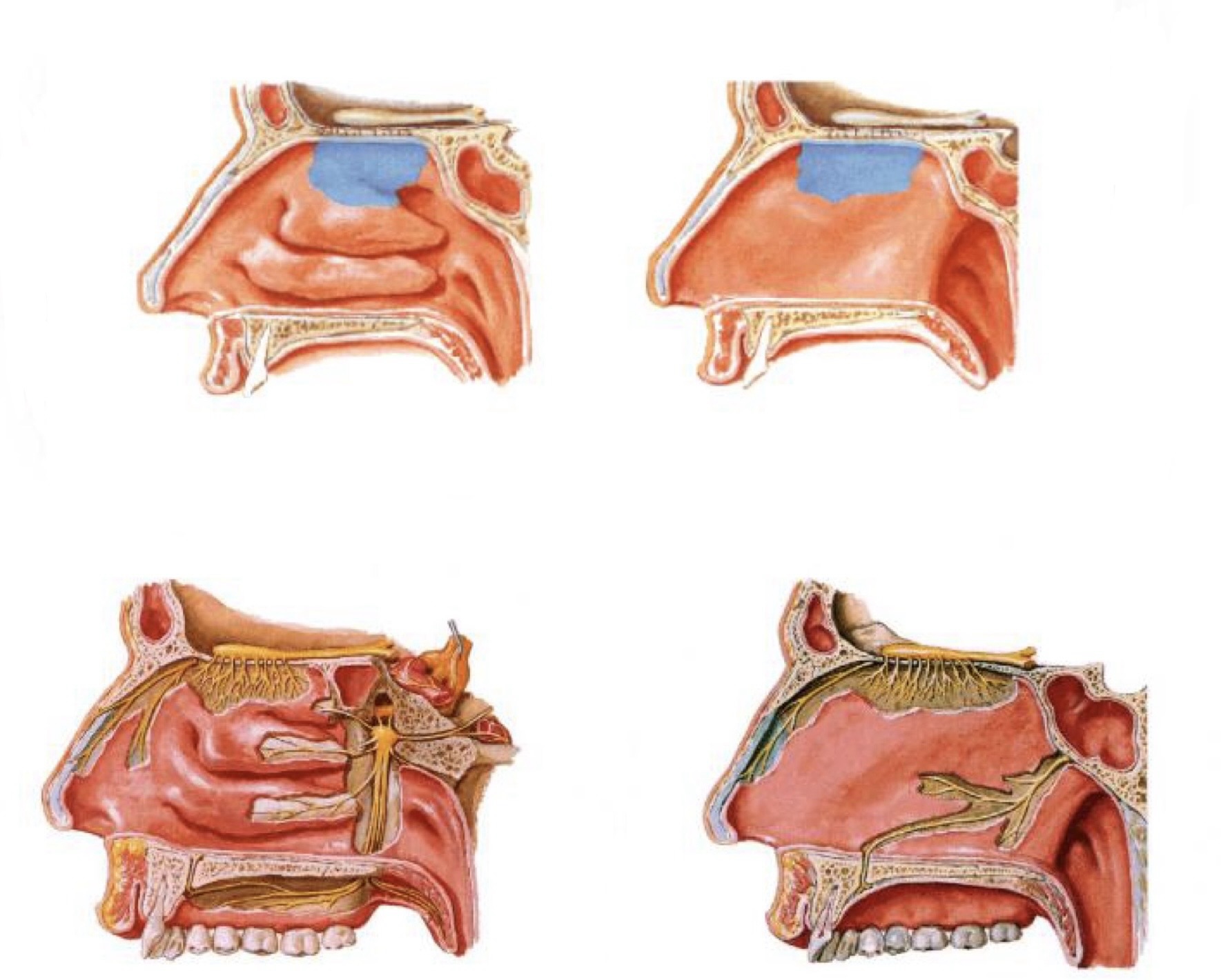 Thần kinh khứu giác (I) thuộc phần trần hốc mũi
