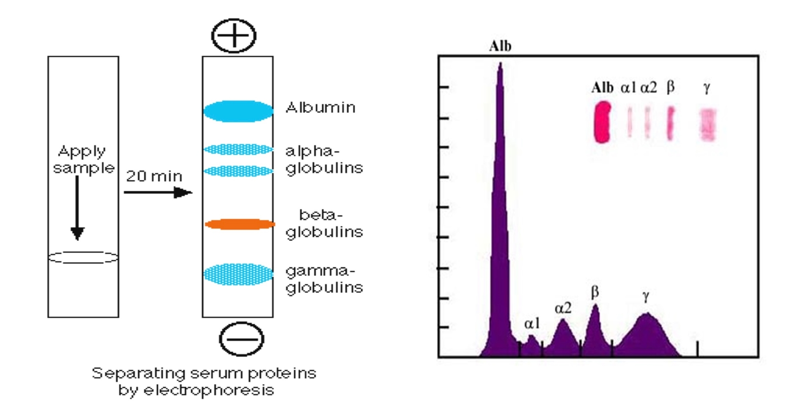 Điện di protein huyết tương