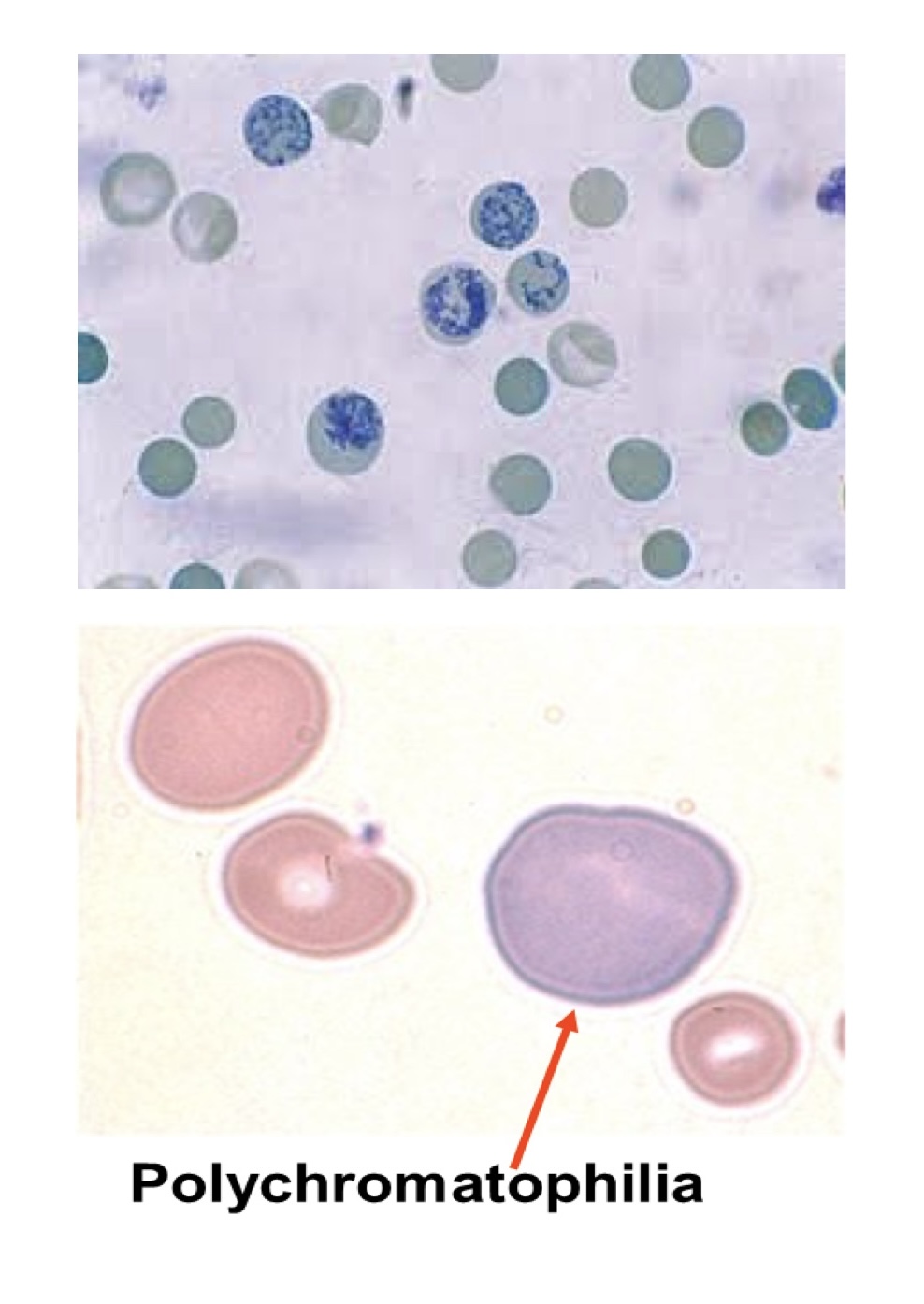Hồng cầu lưới dưới kính hiển vi