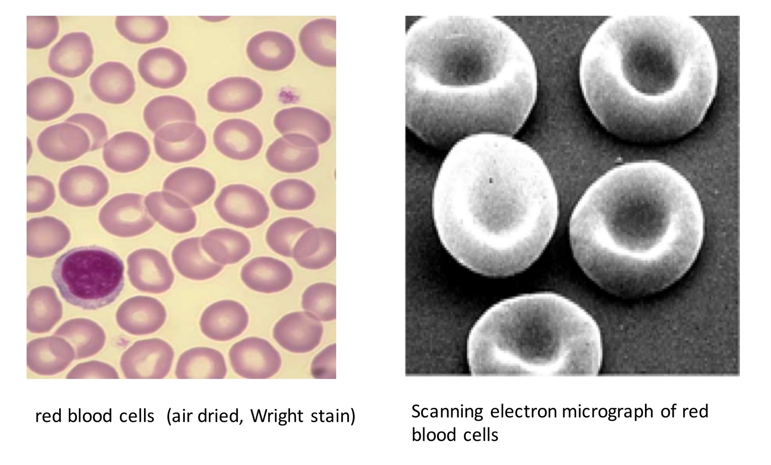 Hồng cầu dưới kính hiển vi