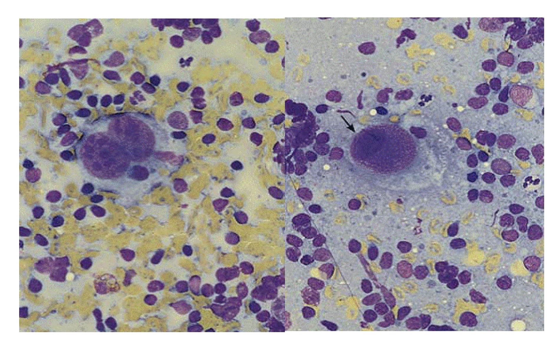 Platelets dưới kính hiển vi