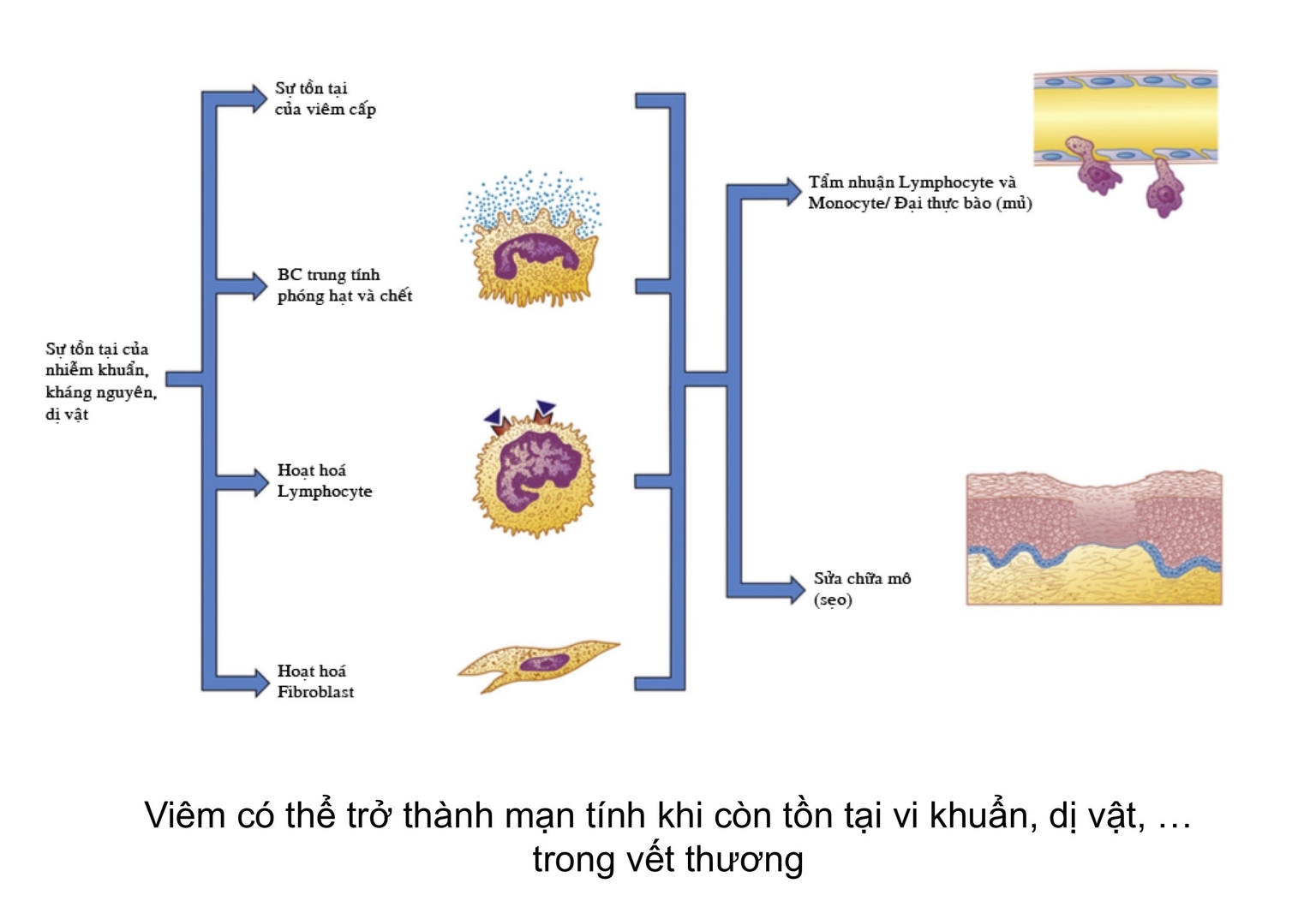 Tiến trình diễn tiến từ viêm cấp thành viêm mạn