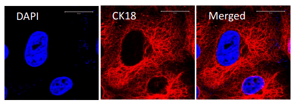 Tế bào biểu mô phế nang với anti-cytokeratin 18  antibody