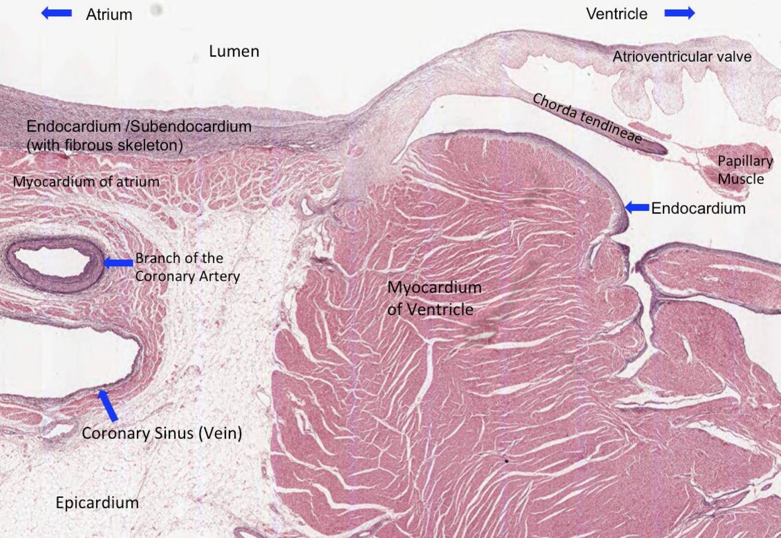Hình ảnh mô học của tim gồm tâm thất, dày & nội tâm mạc
