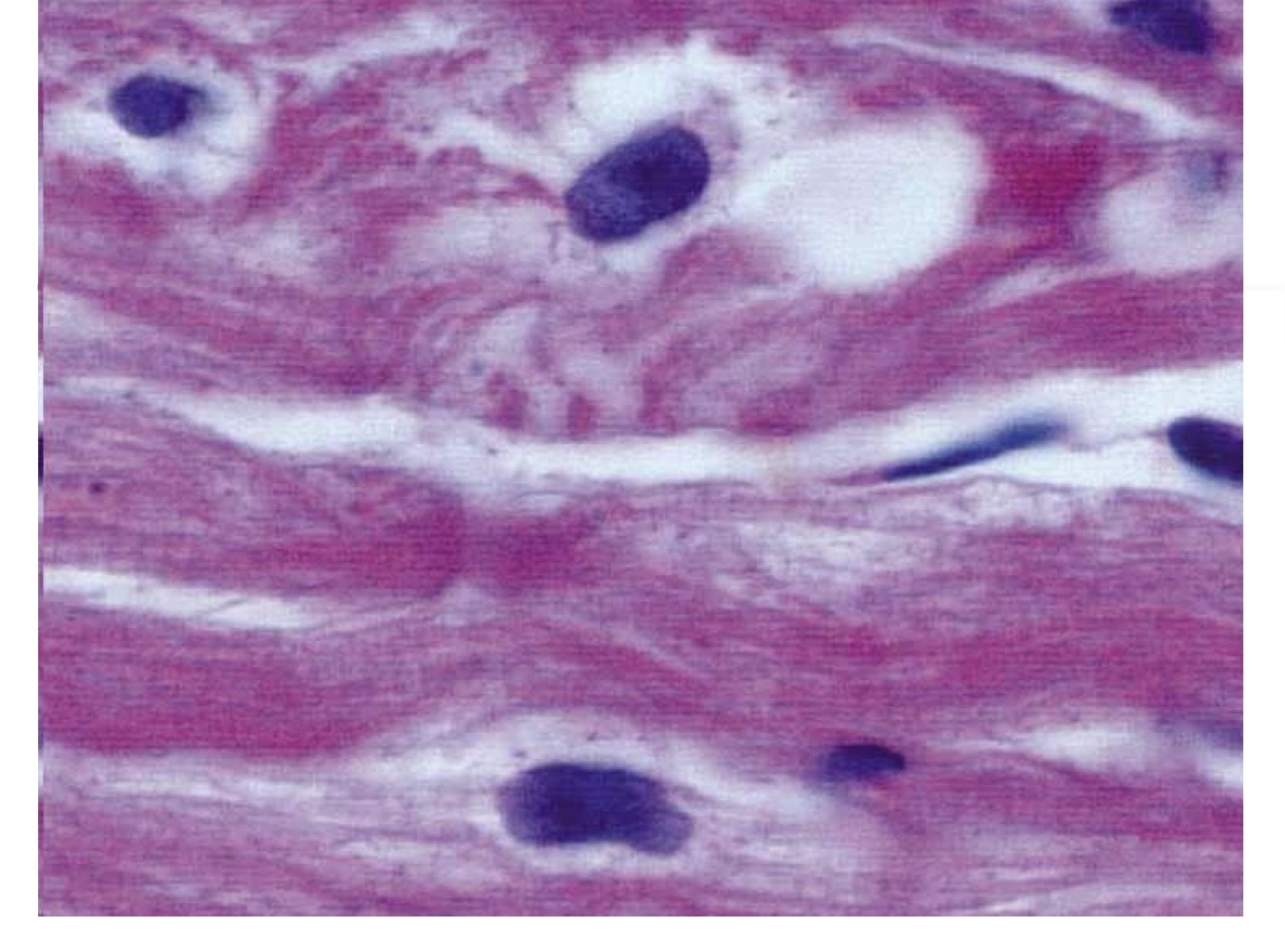 Nhuộm TB TB Purkinje HE bắt màu sáng