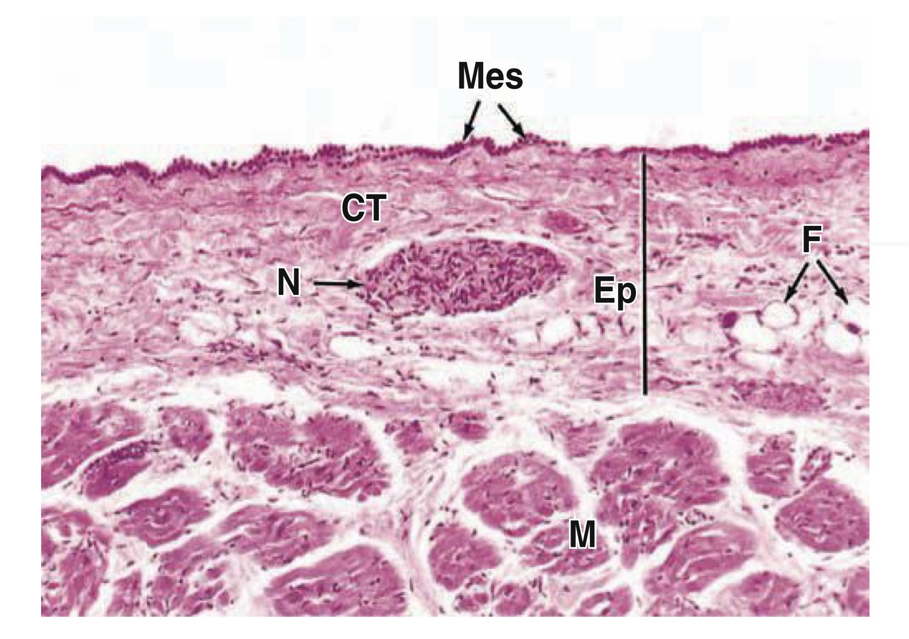 Hình ảnh lớp ngoại tâm mạc