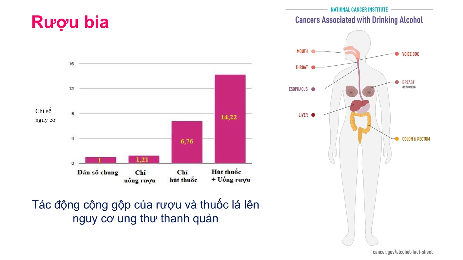 Tác động cộng gộp của rượu và thuốc lá lên nguy cơ UT thanh quản