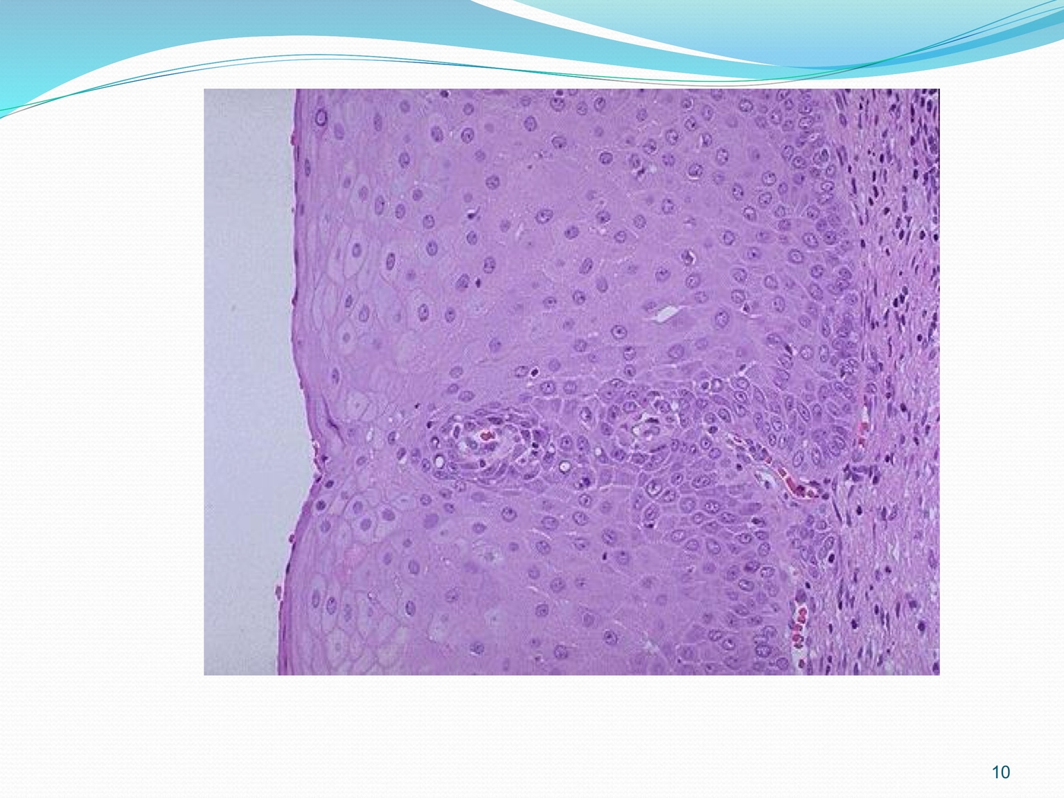 Mô TC bình thường