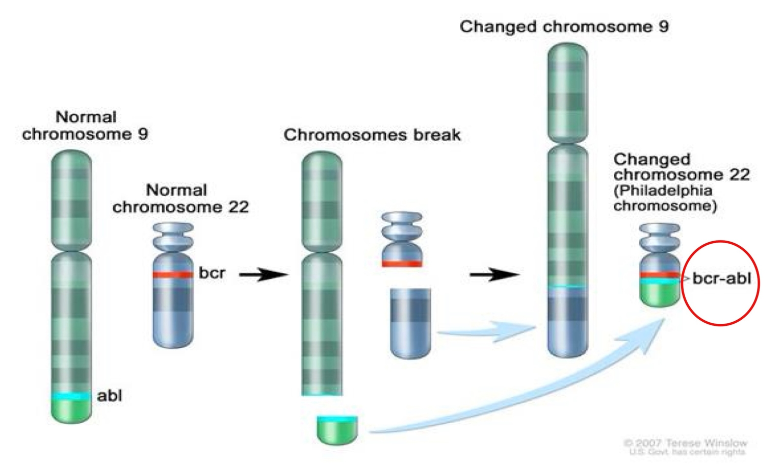 Tái tổ hợp gene BCR-ABL từ NST 9 và NST 22Đường tín hiệu của bcr-abl trong tế bào ung thư