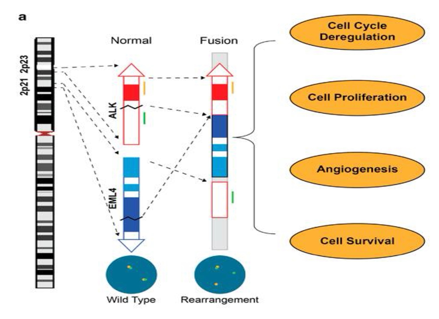 So sánh chức năng gene bình thường và gene EML4-ALK tái tổ hợp